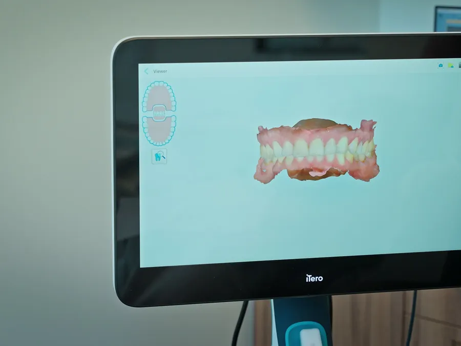 Invisalign at Arch Dental