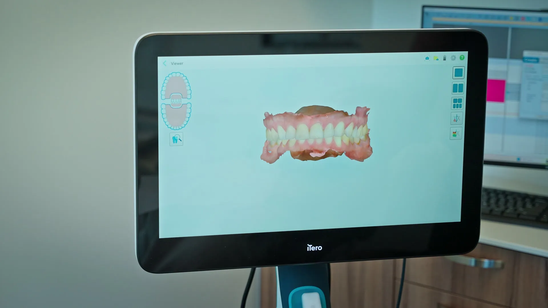 Invisalign at Arch Dental