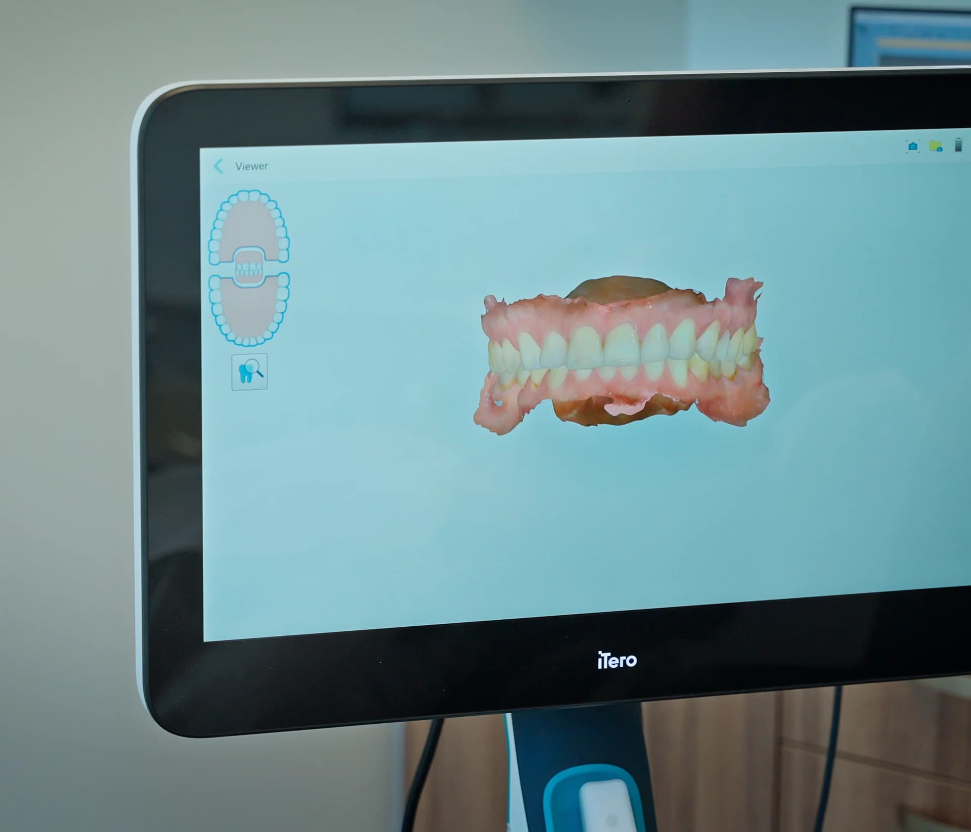 Sedation Dentistry at Arch Dental in Mill Woods